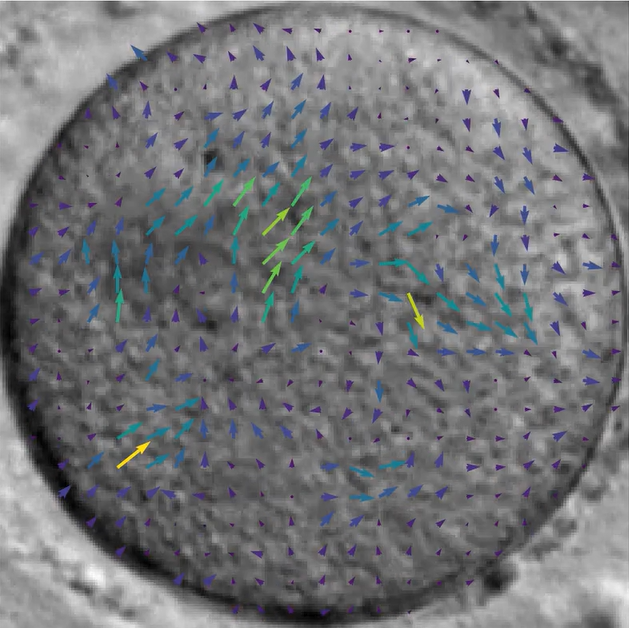 AI analysis of oocytes for IVF